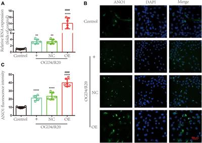 The Novel lncRNA ENST00000530525 Affects ANO1, Contributing to Blood–Brain Barrier Injury in Cultured hCMEC/D3 Cells Under OGD/R Conditions